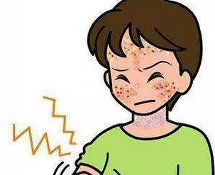 脸部皮炎如何治疗